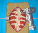 Онлайн игра Operate Now: Scoliosis Surgery.